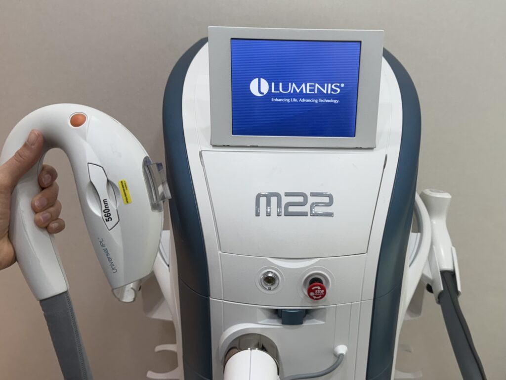 흑자 병변 개선을 위한 M22 IPL