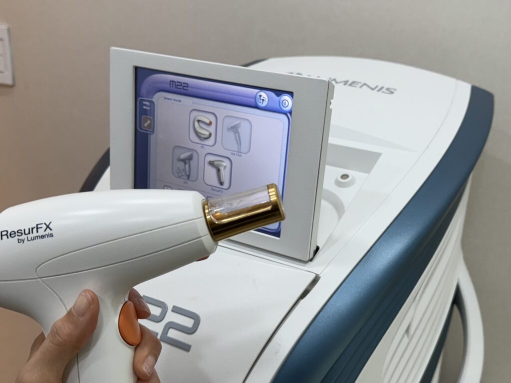 여드름 흉터 개선을 위한 M22 ResurFx 어븀 글래스 비박피성 레이저. 피부를 깎아내지 않기에 자주 받아도 부담이 없다.