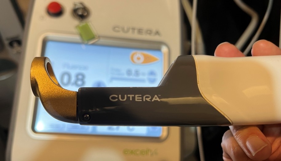 홍조 및 주사 피부 개선을 위해 혈색소에 흡광도가 높은 543nm 파장의 엑셀브이 플러스 레이저를 사용합니다.