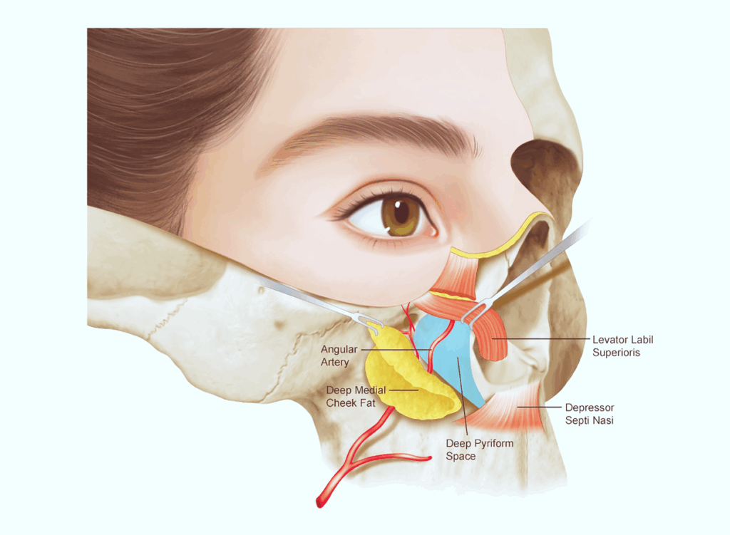 팔자 필러 층별 설계를 위한 해부 그림, nasolabial folds 아래 깊은 위치의 깊은 층, deep pyriform space 구조
