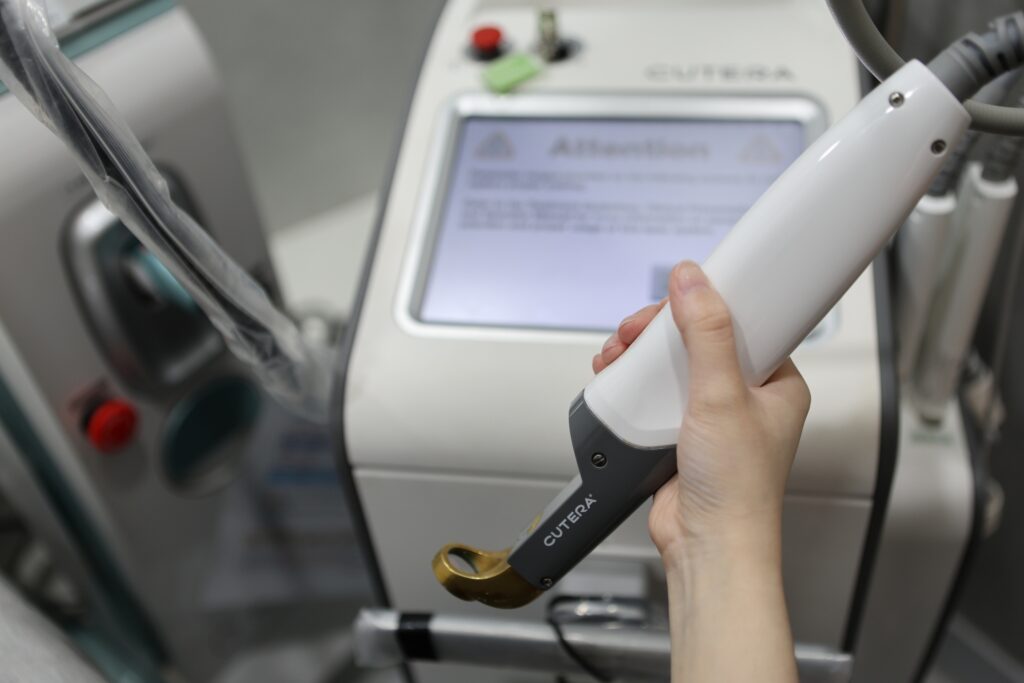 고양시 일산 리뉴앤영 의원에서 얼굴 모세혈관 확장증 치료에 사용하는 엑셀브이 플러스 혈관 레이저 장비