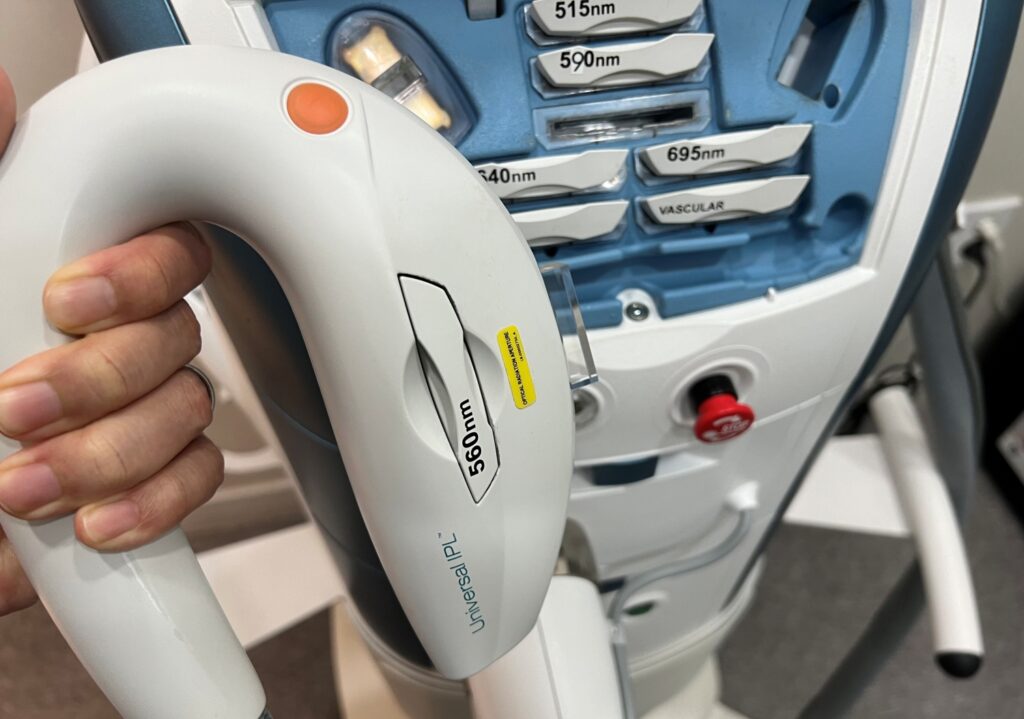 고양시 일산 리뉴앤영 의원에서 얼굴 모세혈관 확장증 및 홍조 치료에 활용되는 M22 IPL 장비