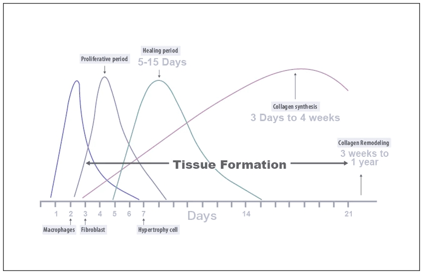 써마지 고주파 시술 후 즉각적 콜라겐 수축과 2~6개월에 걸친 콜라겐 재생 효과를 나타낸 그래프