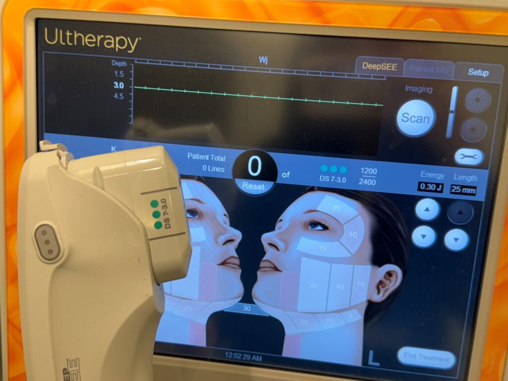 고양시 리뉴앤영 일산 울쎄라 정품 핸드피스와 트랜스듀서 모습