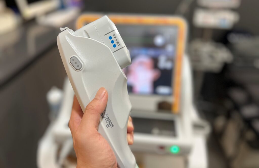 울쎄라 초음파 에너지를 전달하는 핸드피스와 트랜스듀서 모습