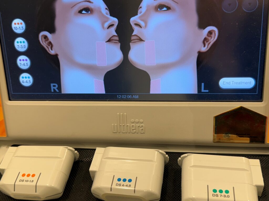 일산 리뉴앤영에서 울쎄라 시술에 사용하는 다양한 깊이의 트랜스듀서(1.5mm, 3.0mm, 4.5mm)