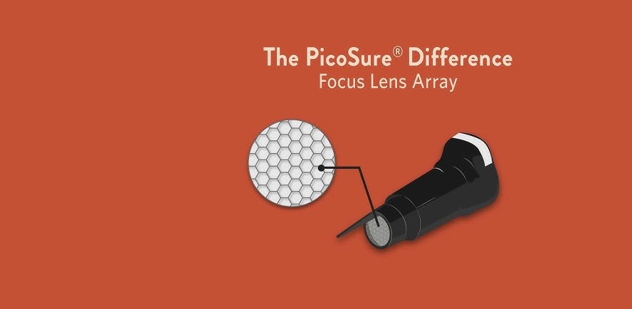 피코슈어 포커스 렌즈 어레이(Focus Lens Array)