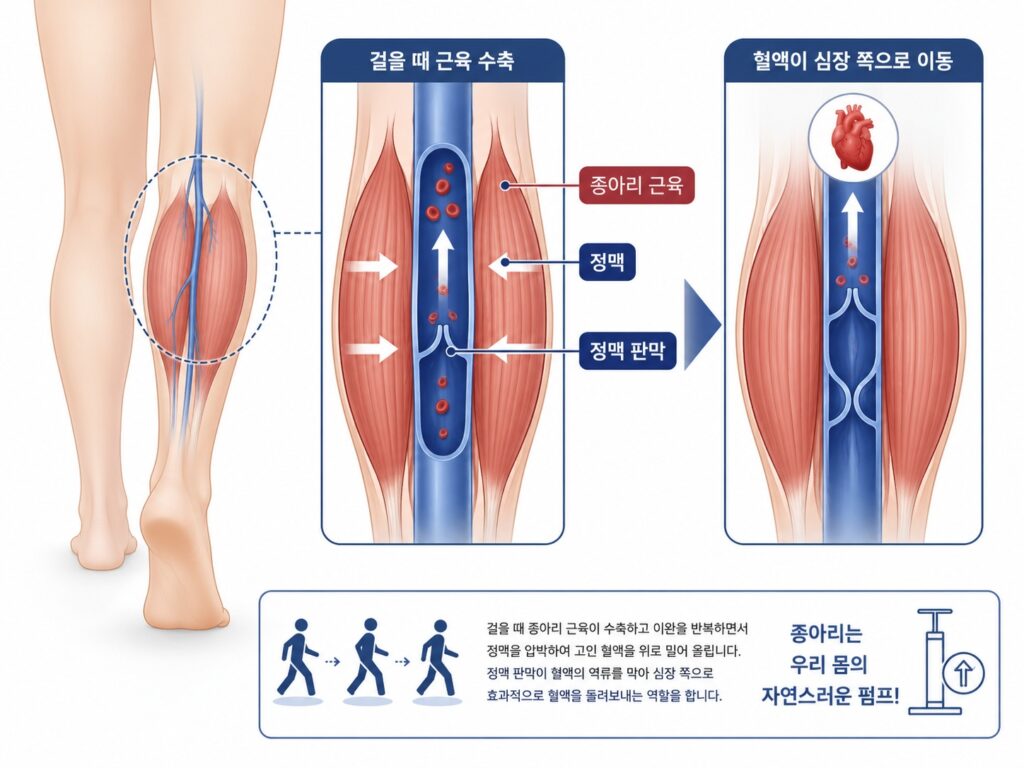 종아리 보톡스보다 다른 방법을 먼저 고려해야 하는 경우를 설명하는 그림으로, 종아리 근육이 다리의 혈액을 심장으로 올려보내는 펌프 역할과 부종·하지정맥류에서 종아리 보톡스 한계를 보여주는 이미지
