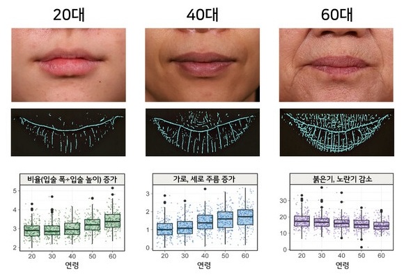 입술 필러 시술 전 노화로 얇아진 입술과 세로 주름, 볼륨 감소를 보여주는 이미지