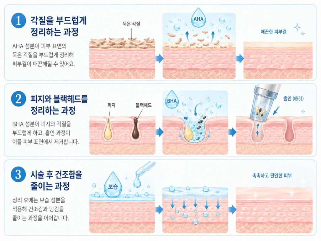 AHA로 묵은 각질을 정리하고, BHA와 흡인으로 피지·블랙헤드를 제거한 뒤, 보습으로 마무리하는 일산 아쿠아필 관리 과정 개념도