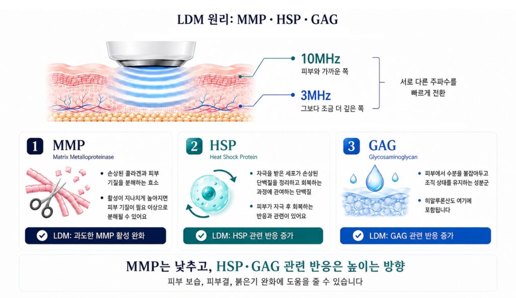 LDM 관리의 원리로 3MHz와 10MHz 이중 주파수 초음파가 피부에 전달되어 MMP는 낮추고 HSP와 GAG 관련 반응은 높이는 과정을 설명한 이미지
